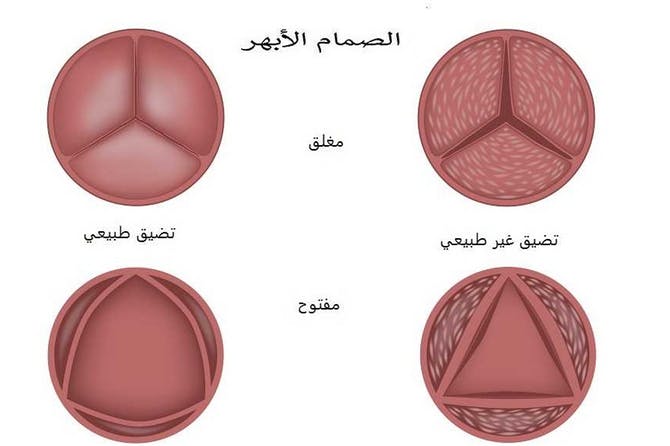 اسماء صمامات القلب - القلب هو اساس الجسم