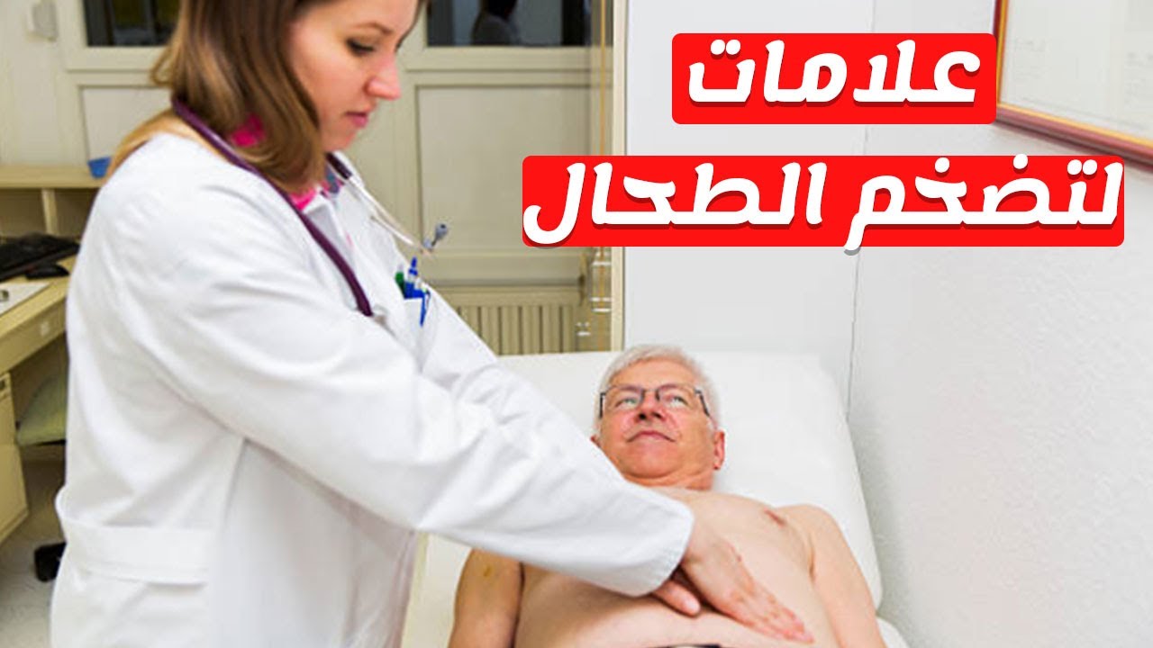 تضخم الطحال - تعرف على اسباب واعراض تضخم الطحال 3544 1