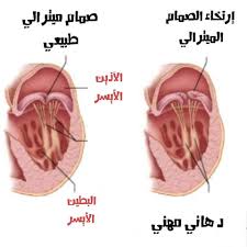 اسماء صمامات القلب - القلب هو اساس الجسم 14349 10