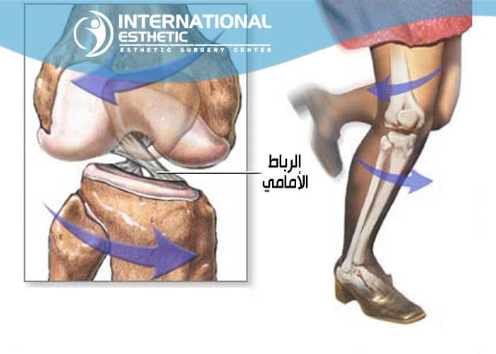 عملية الرباط الصليبي - ماهو الرباط الصليبي وطرق علاجة 4184 1