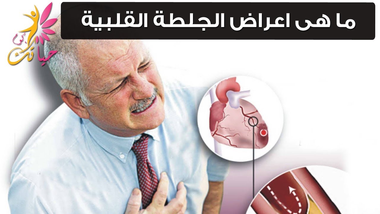 اعراض الجلطة , ما هي جلطه القلب واعراضها والامراض المسببة لها