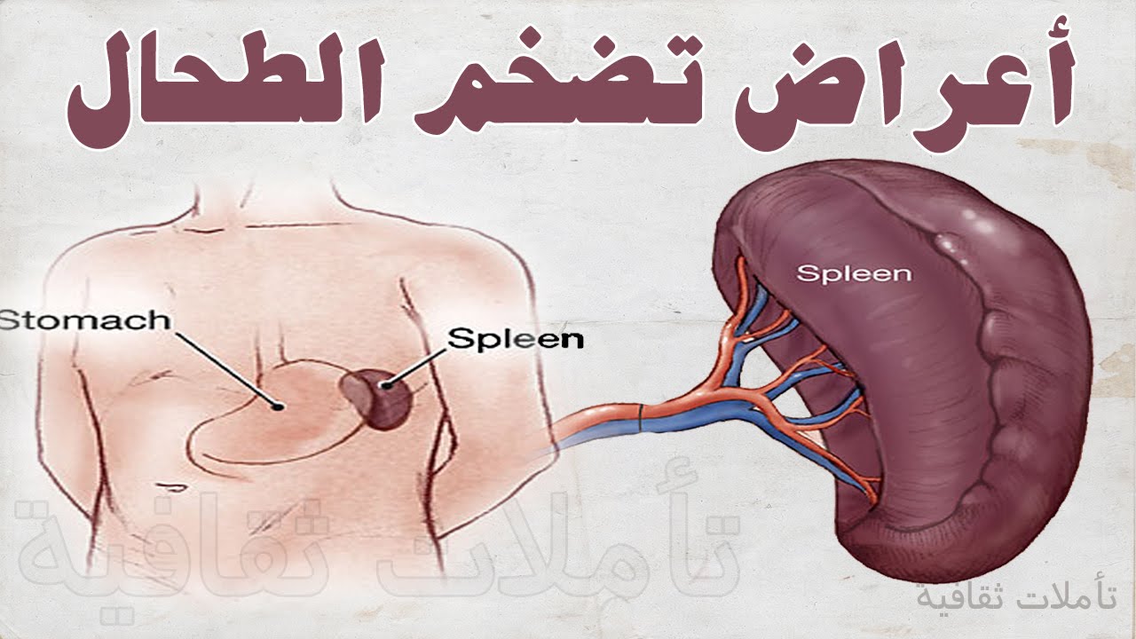 تضخم الطحال - تعرف على اسباب واعراض تضخم الطحال 3544