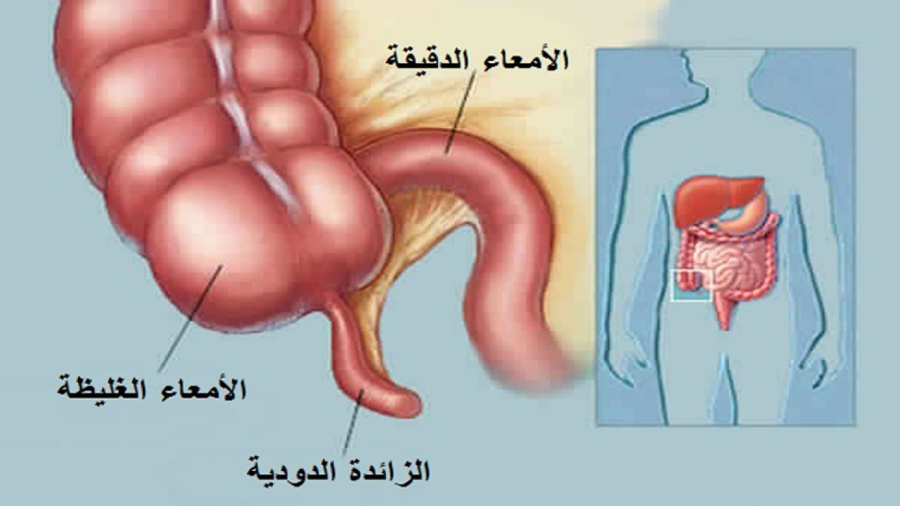 الزائدة الدودية- اعراض التهاب الزائدة الدودية وخطرها 1505 10