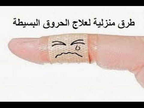 كيفية علاج الحروق - اسرع حل لمشاكل الحروق 14358 2