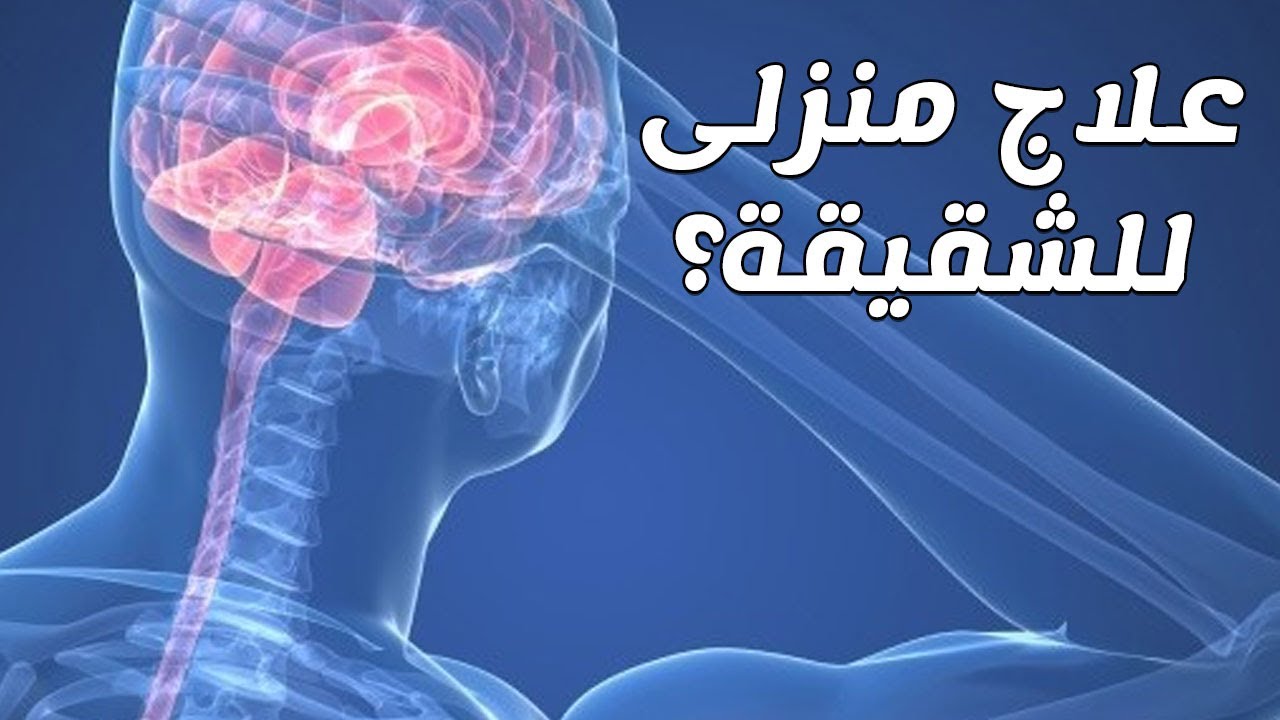 اغرب مرض ممكن تتعرضوا ليه , مرض الشقيقة