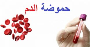 3950 3 حموضة الدم - علاج حموضة الدم شدة الرال