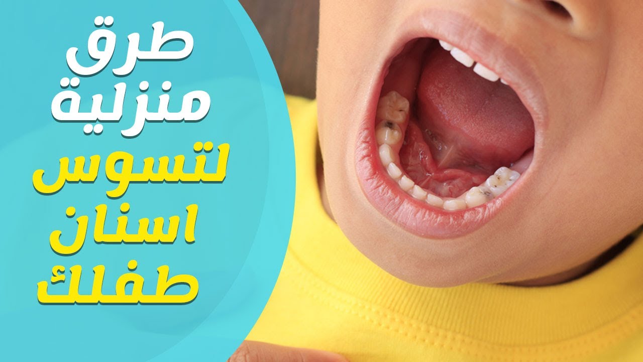 1010 4 تسكين الم الاسنان- التخلص من مشاكل الاسنان تذكير صفا