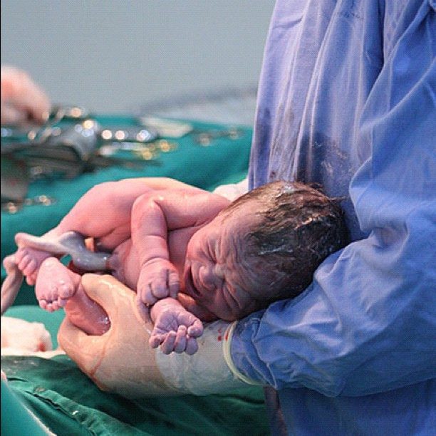 دعاء الولادة القيصرية آمنة مقارنة مع