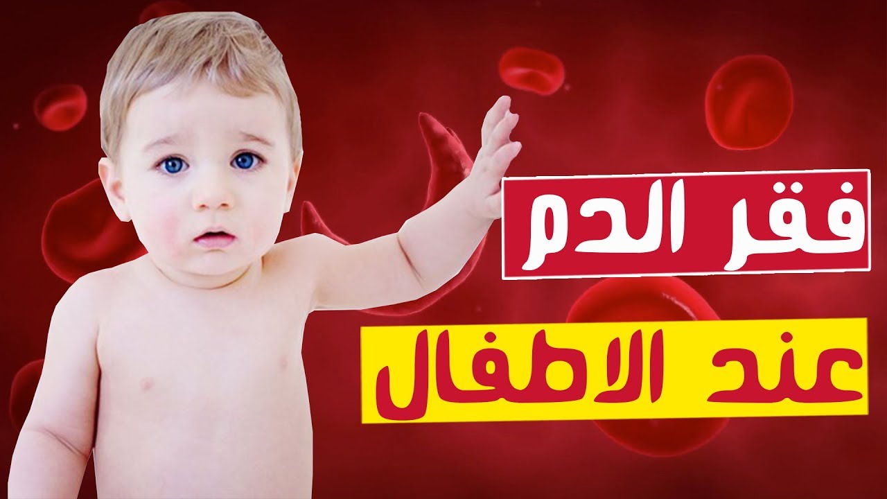 معلومات كبيرة عن فقر الدم , اعراض فقر الدم للاطفال - روح اطفال
